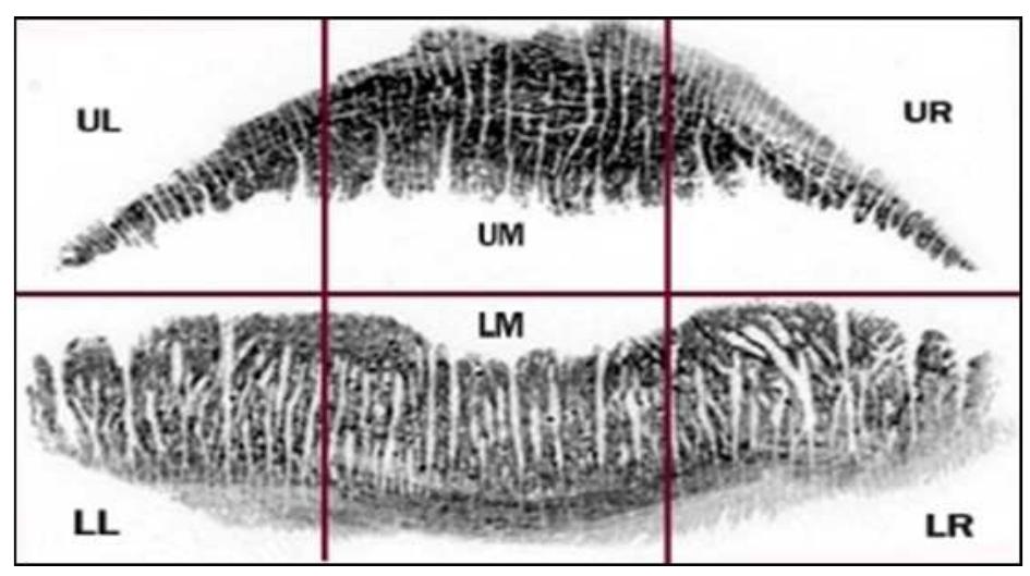 FIGURE 1:The six topography area of the lips named accordingly from left to right as upper left section (UL), upper middle section (UM), upper right section (UR), lower left section (LL), lower middle section (LM) and lower right section (LR) (Nur Sabrina Sarah et al. 2019)  The results showed that type II was the dominant type for four sections: upper left, upper right, lower right and  Table 5 shows percentages of lip print pattern in different section between males and females. For the upper left section, females showed higher percentage of lip print 