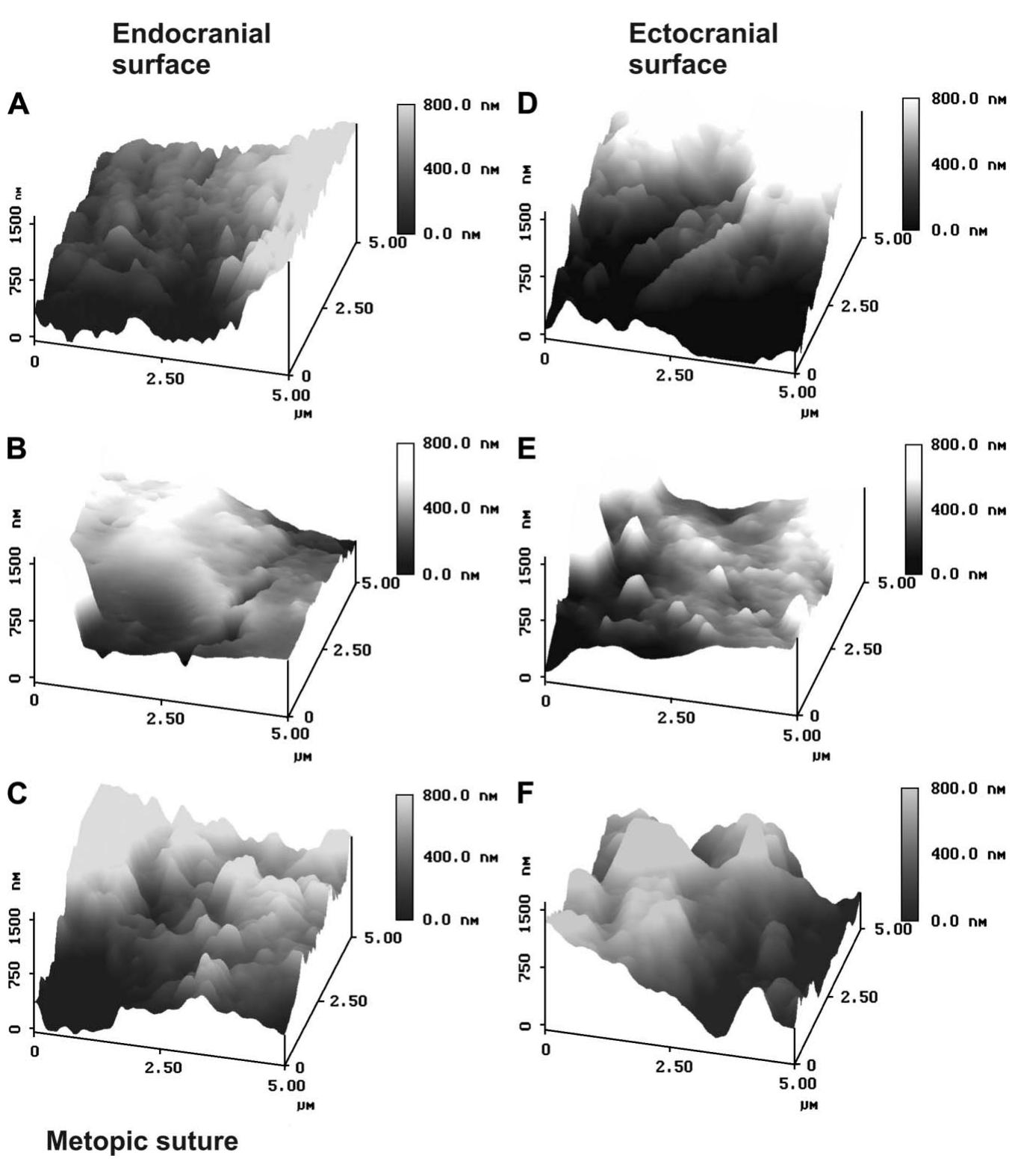 cranial sutures. After previous investigations of nanoscale structures by physical scientists, AFM has been recently used by biomedical scientists to  investigate the molecular, ce tures. The present study is ongoing investigations of  AFM.""'® In our previous s  lular, and tissue struc- a continuation of our  skeletal tissues using udies, AFM was used  as a nanoindentation device for measuring the phys-  ical properties of articular  cartilage, chondrocyte  matrices, cranial sutures, and front.  sutural mineralization 