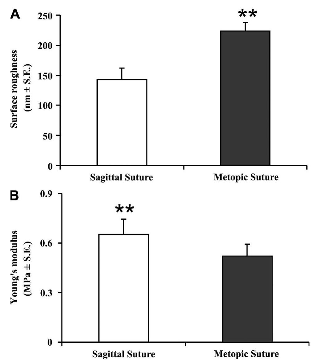 Fig 4 Quantification of surface topography and Young’s moduli of the synostosed sagittal and metopic sutures. (A) Histograms of mean surface roughness (R,) of synos- tosed sagittal and metopic sutures (**P < 0.01). (B) Histo- grams of Young’s moduli (E) of synostosed sagittal and metopic sutures (**P < 0.01). 
