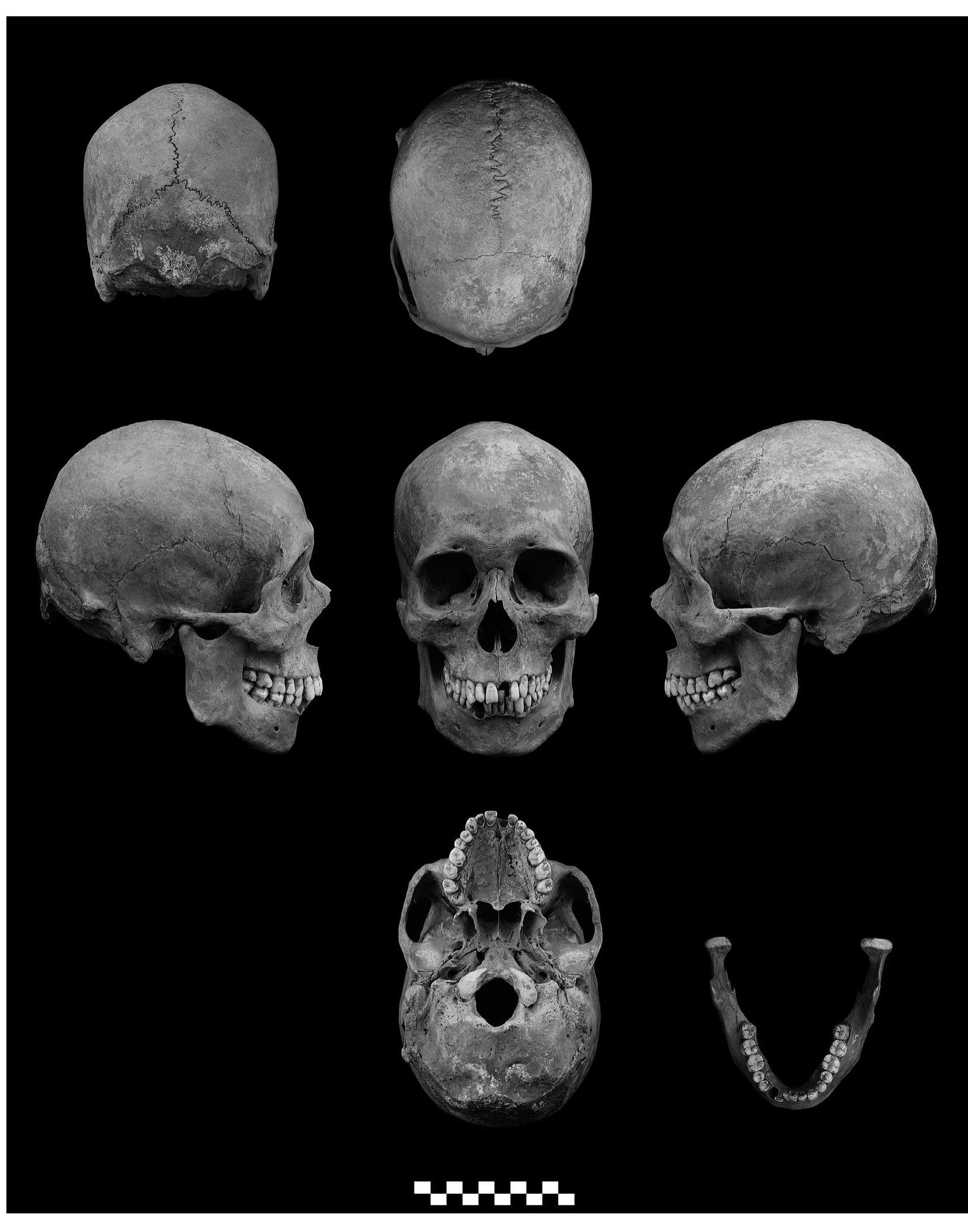 Fig. 1. Photographs of the skull of No. 583. 
