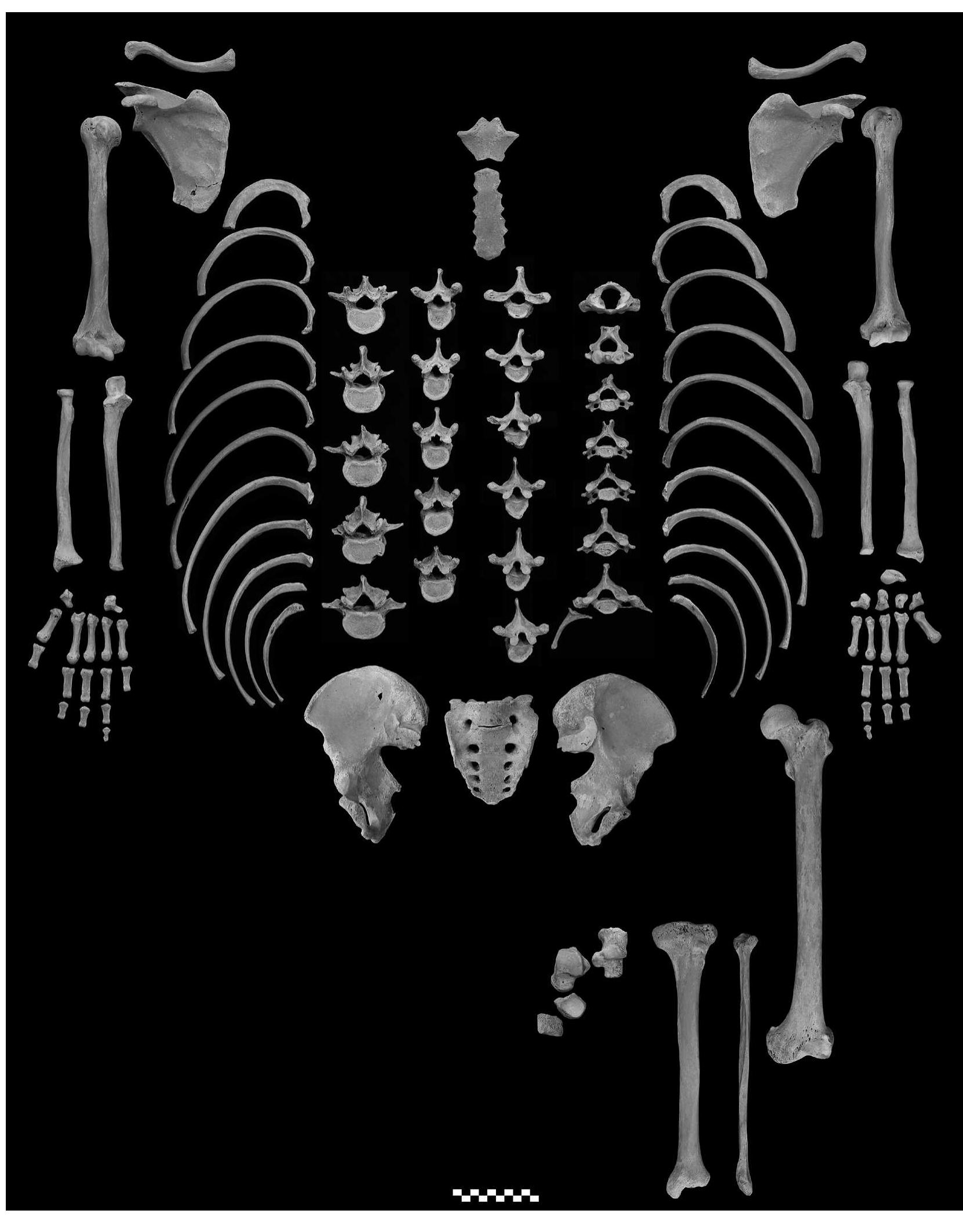 ig. 2. Photographs of the postcranial bones of No. 583. 
