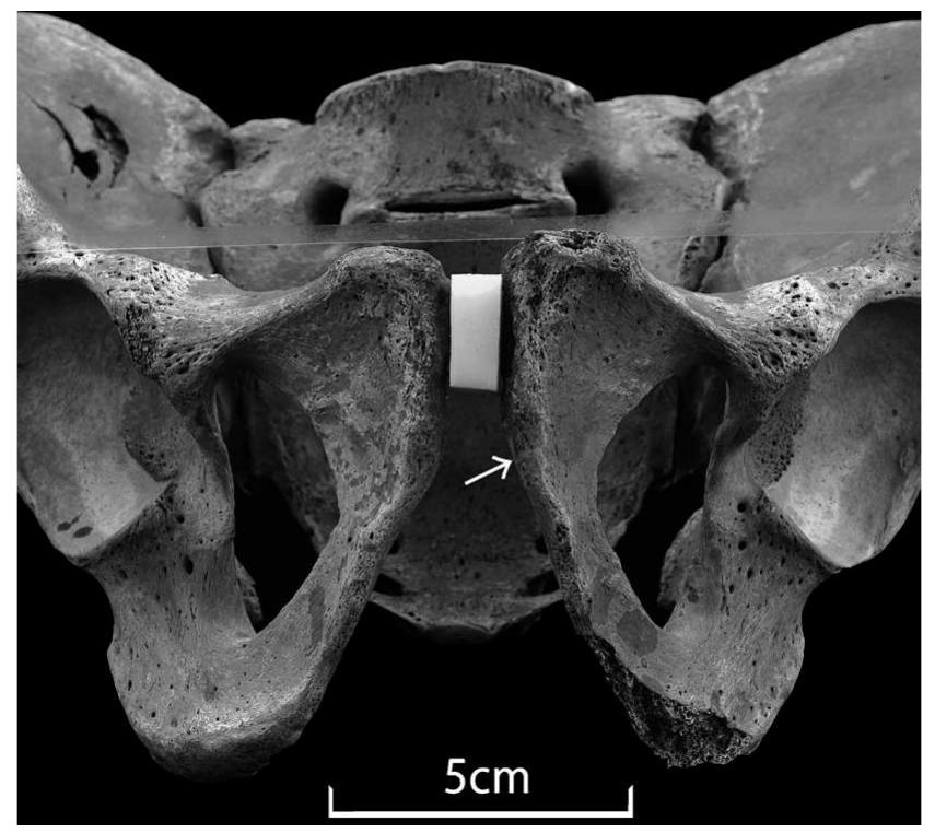 Fig. 6. 3D images of the cut mark reconstructed in Keyence VR-3000. 