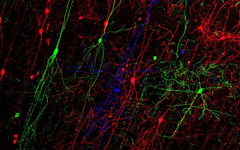 GABAergic cells